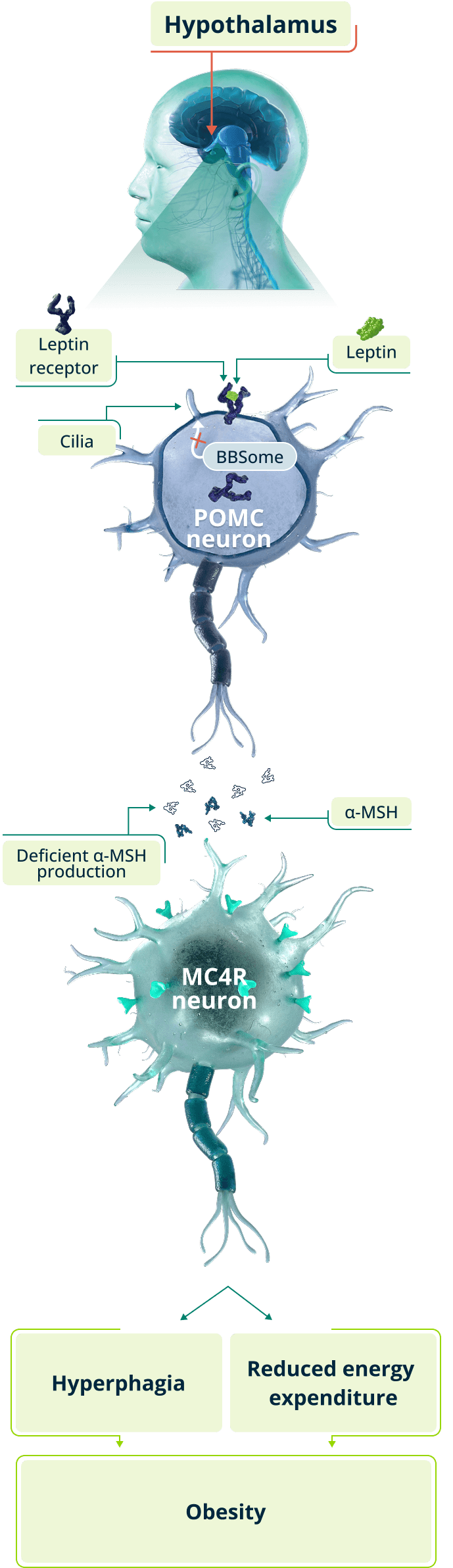 MC4R pathway impairment in BBS showing disrupted signaling leading to reduced satiety and increased hunger